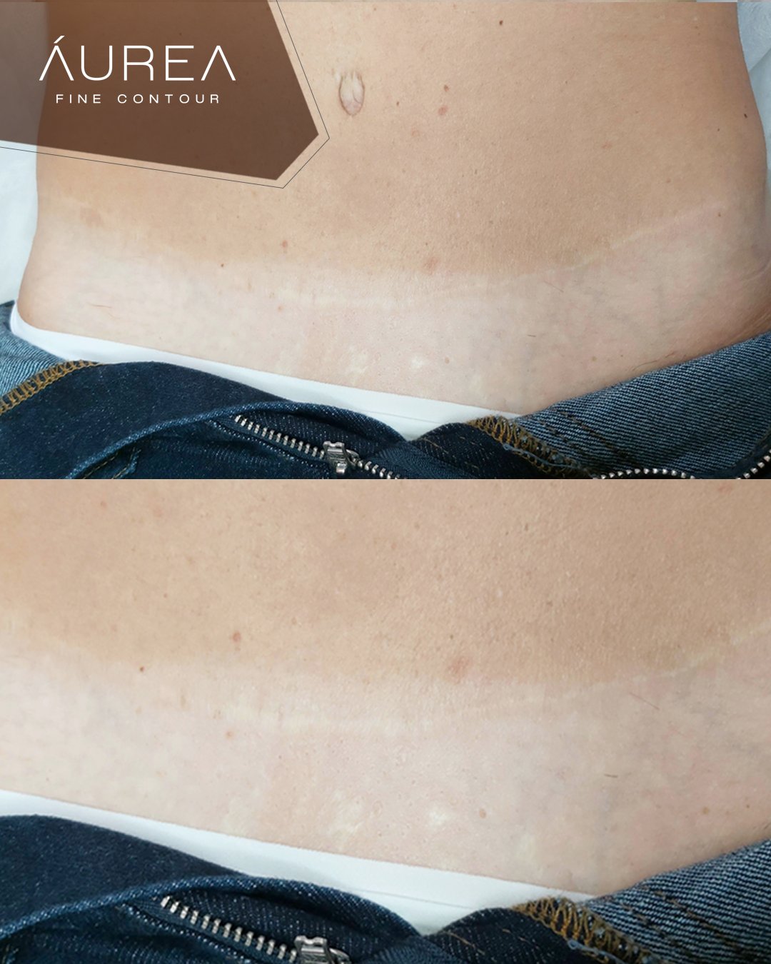 Resultado Protocolo Áurea Skin