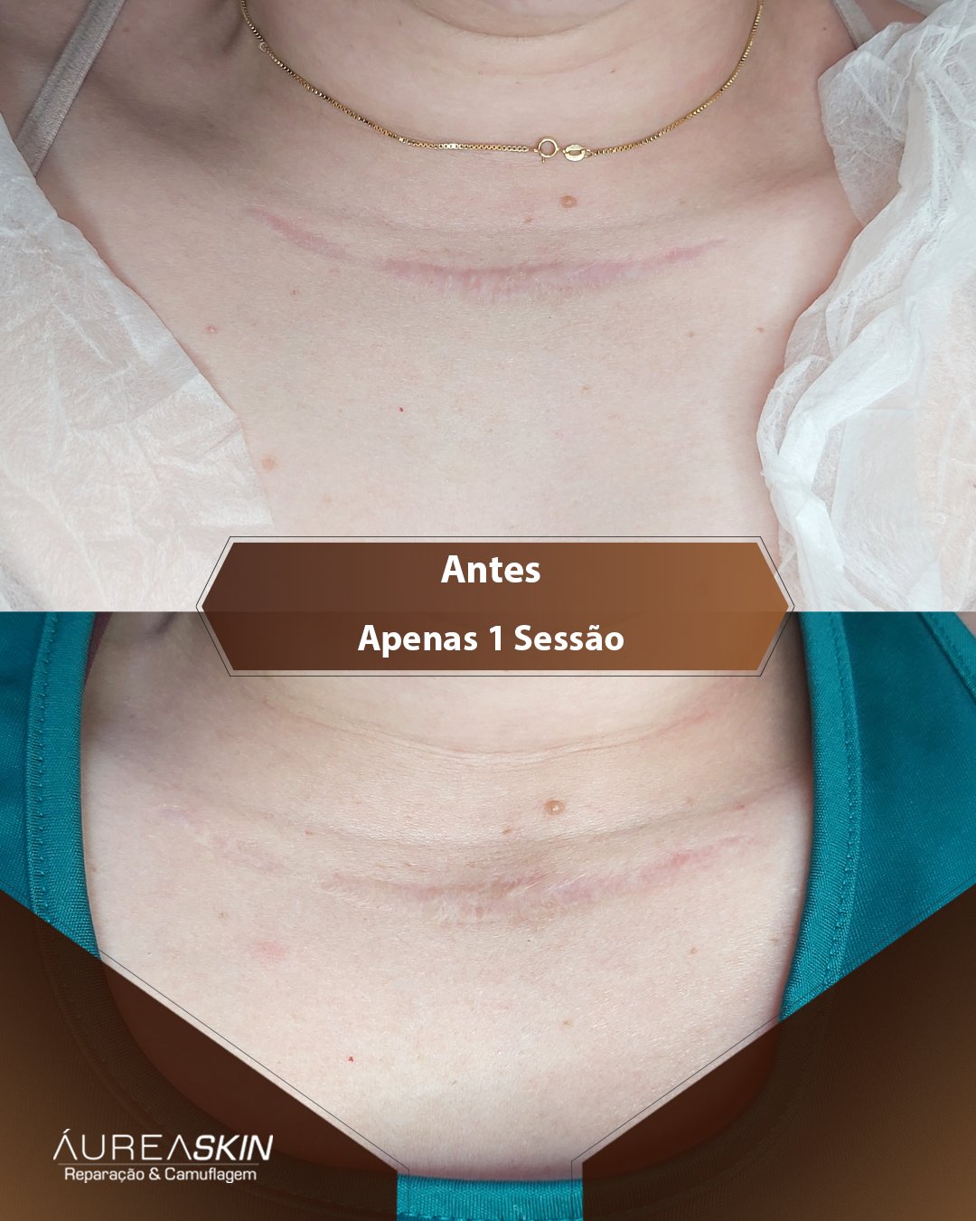 Resultado Áurea Skin
