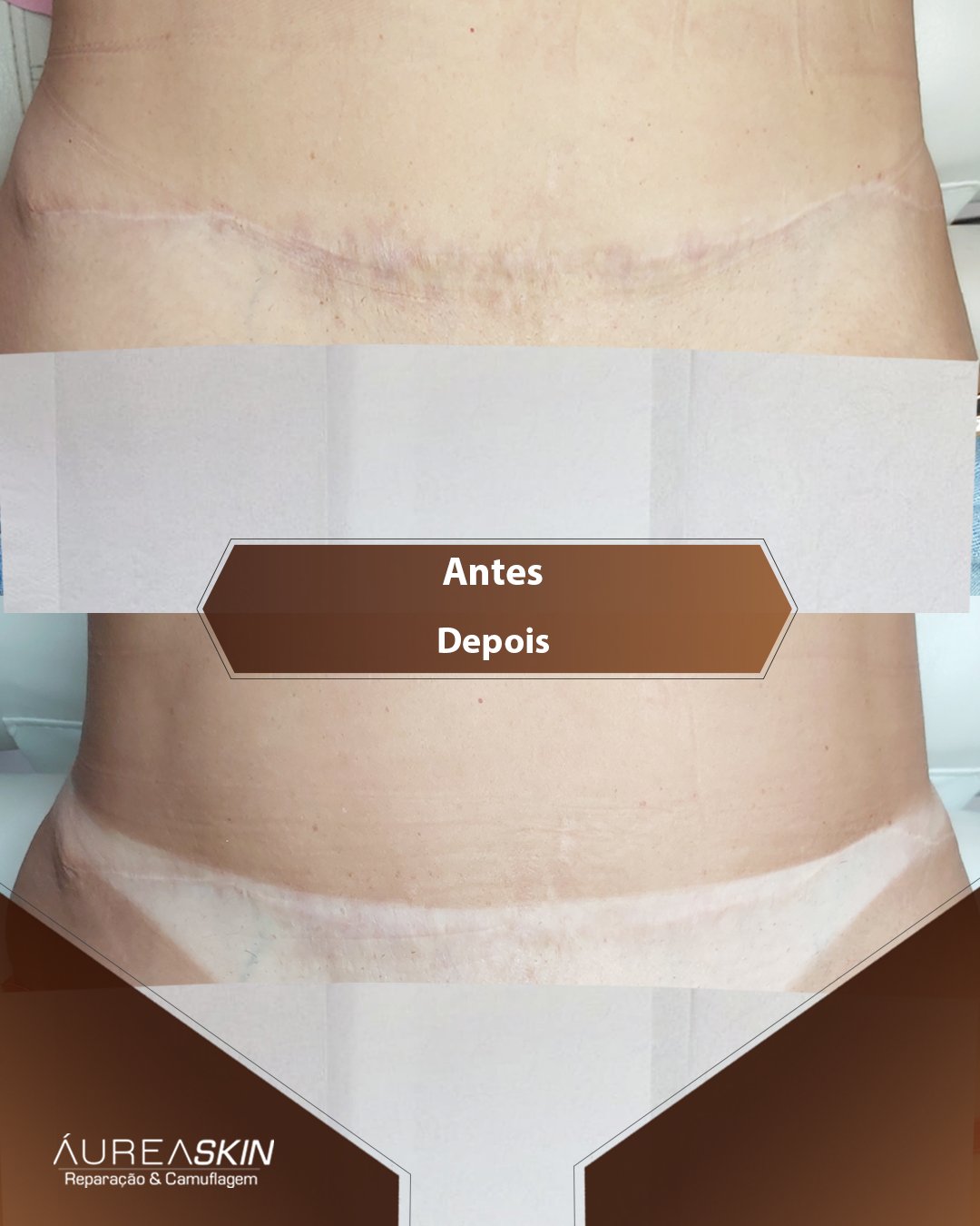 Resultado Áurea Skin