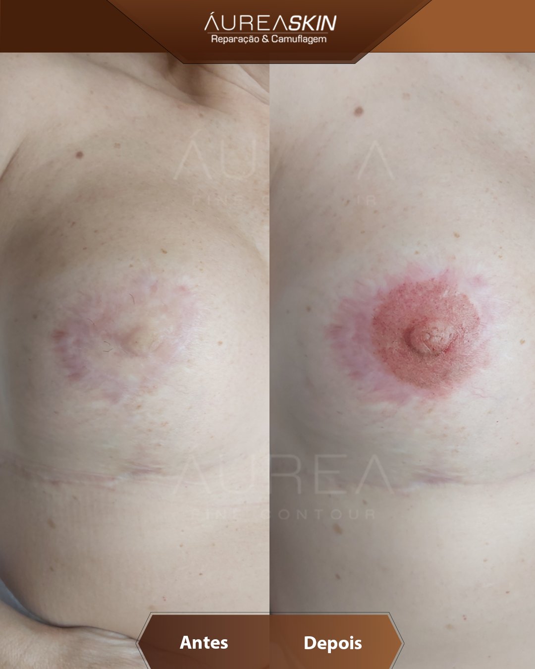Resultado Áurea Skin