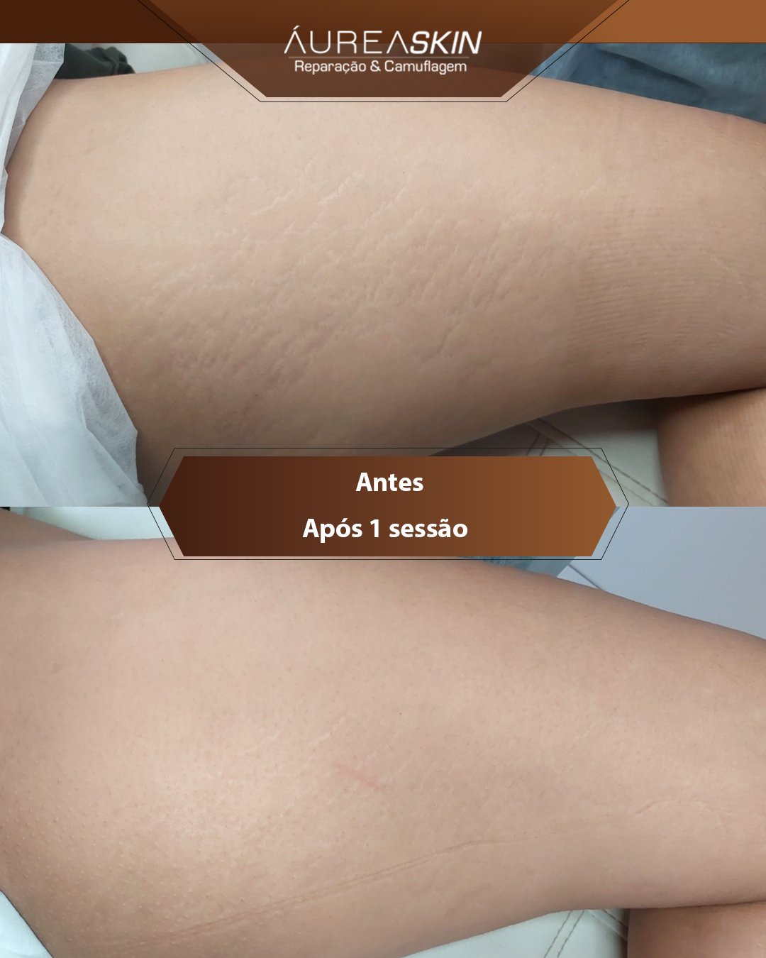 Resultado Áurea Skin